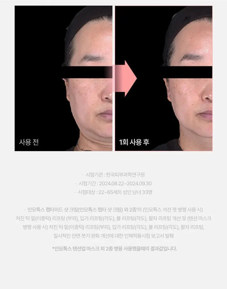 [붓기/리프팅/쿨링] 메디테라피 텐션 업 마스크 (5매입/1매입) 상세페이지 25